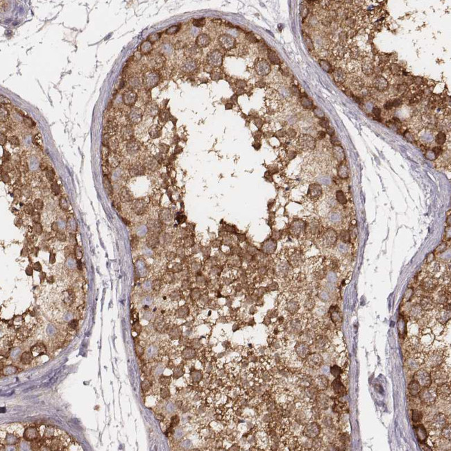 CARS Antibody in Immunohistochemistry (Paraffin) (IHC (P))