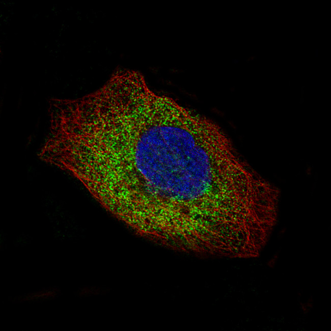 Laminin gamma-2 Antibody in Immunocytochemistry (ICC/IF)