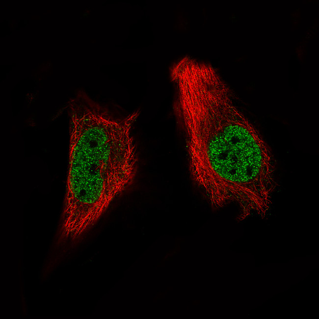 ARID1A Antibody in Immunocytochemistry (ICC/IF)