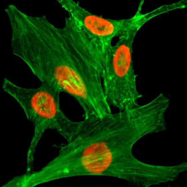 H2A.ZK4ac Antibody in Immunocytochemistry (ICC/IF)