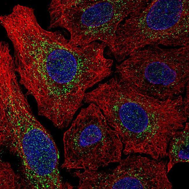 MCU Antibody in Immunocytochemistry (ICC/IF)