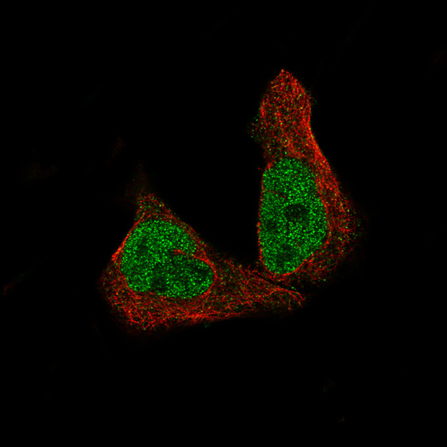 METTL14 Antibody in Immunocytochemistry (ICC/IF)