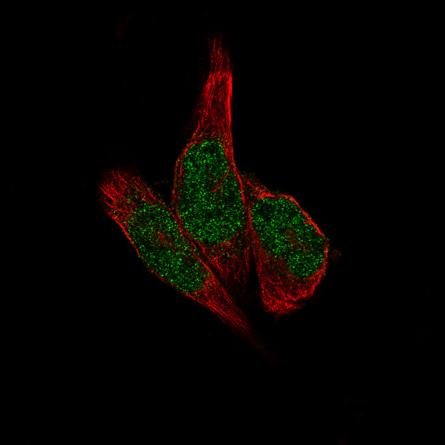 METTL14 Antibody in Immunocytochemistry (ICC/IF)