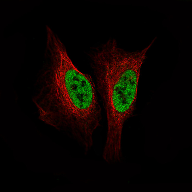 SMCHD1 Antibody in Immunocytochemistry (ICC/IF)