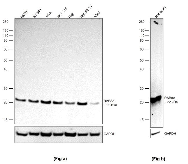 RAB8A Antibody in Western Blot (WB)