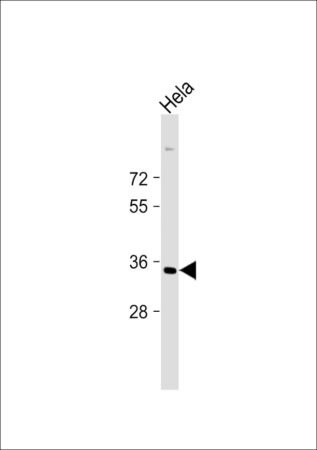 STRA8 Antibody in Western Blot (WB)