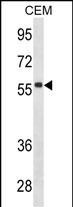 Human IgD Antibody in Western Blot (WB)