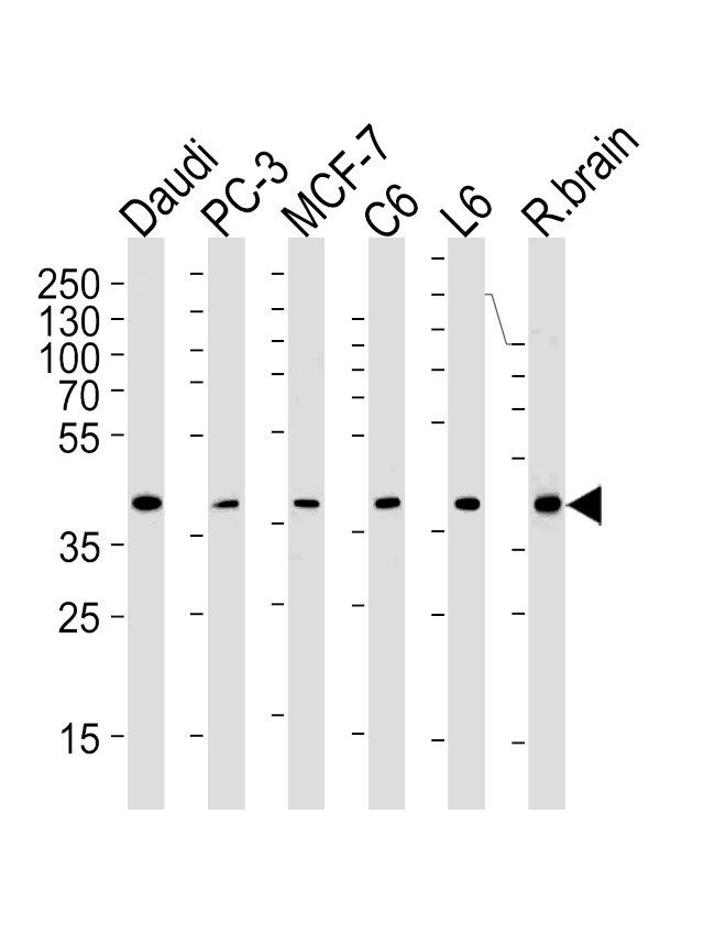 CREB3L4 Antibody in Western Blot (WB)