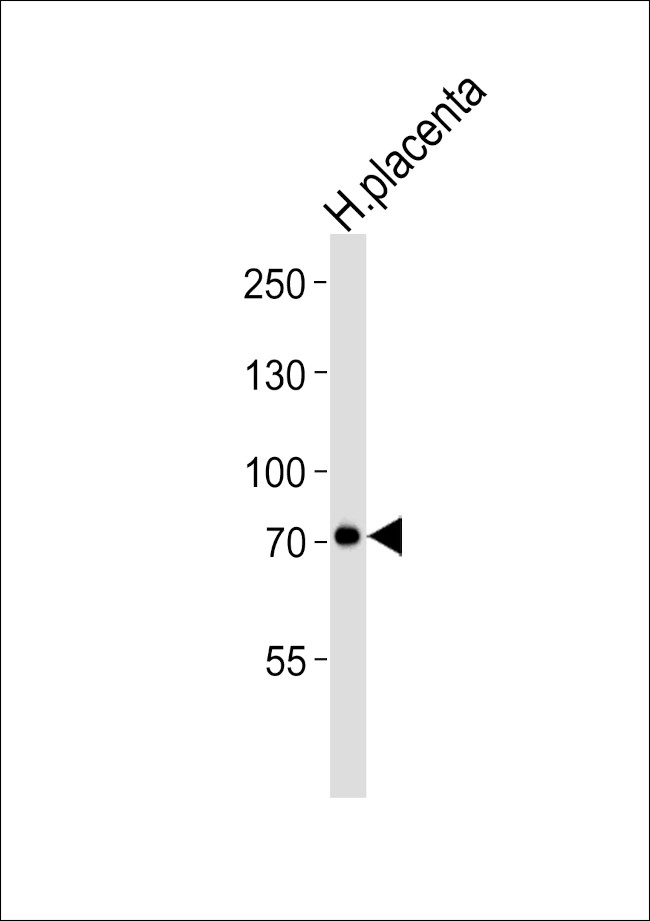 Calpain 6 Antibody in Western Blot (WB)