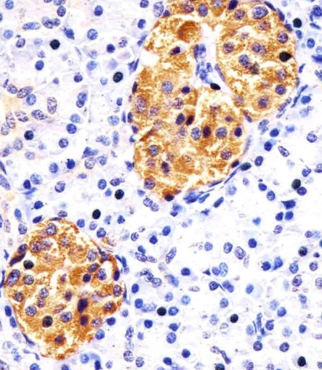 RAB3B Antibody in Immunohistochemistry (Paraffin) (IHC (P))