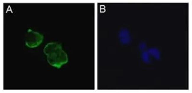 SCN5A Antibody in Immunocytochemistry (ICC/IF)