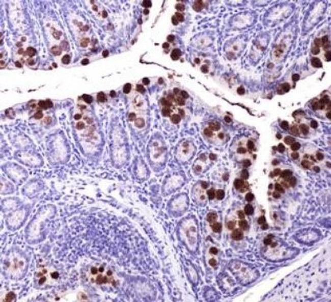 ABCG8 Antibody in Immunohistochemistry (IHC)