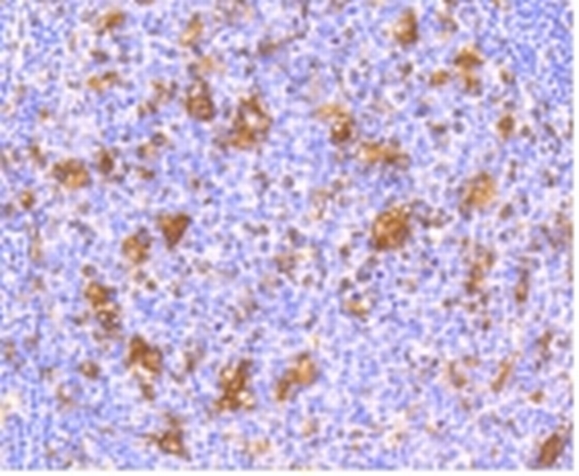 IFNAR1 Antibody in Immunohistochemistry (Paraffin) (IHC (P))