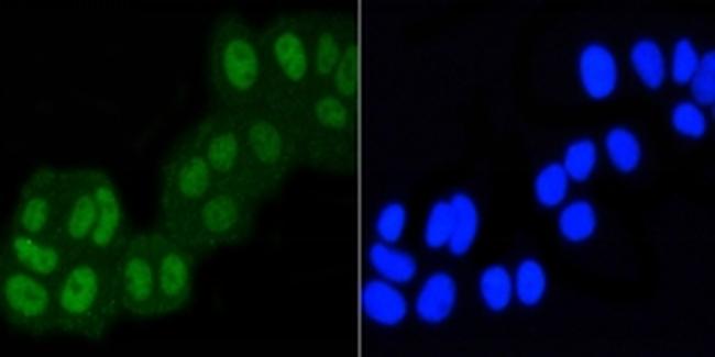 ASH2L Antibody in Immunocytochemistry (ICC/IF)