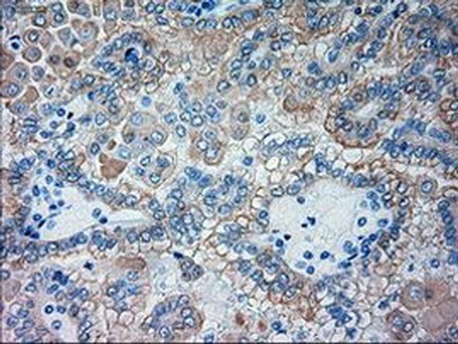 GSC Antibody in Immunohistochemistry (Paraffin) (IHC (P))