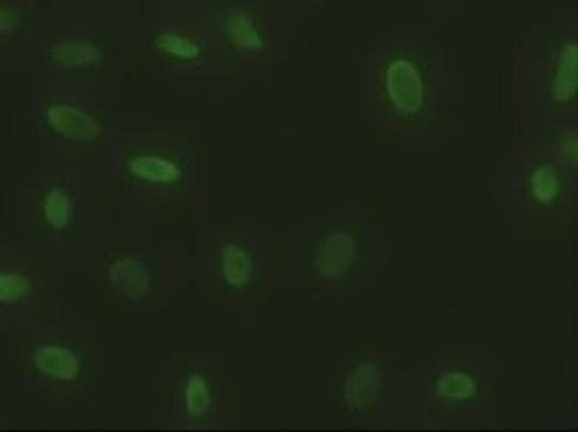 SOX17 Antibody in Immunocytochemistry (ICC/IF)