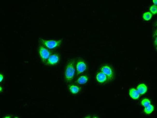 Adenylate Kinase 1 Antibody in Immunocytochemistry (ICC/IF)