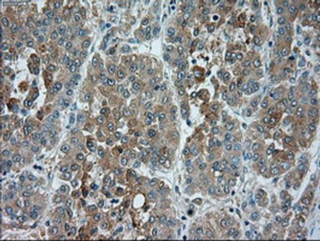 TRPM4 Antibody in Immunohistochemistry (Paraffin) (IHC (P))