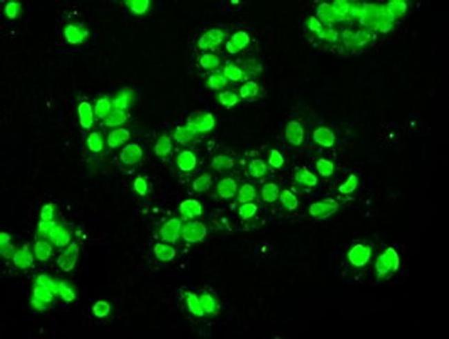 SSB Antibody in Immunocytochemistry (ICC/IF)