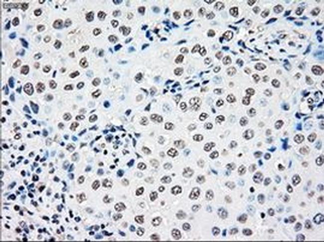 RAD9 Antibody in Immunohistochemistry (Paraffin) (IHC (P))