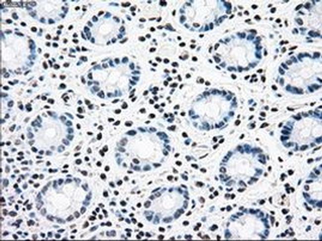 CNDP1 Antibody in Immunohistochemistry (Paraffin) (IHC (P))