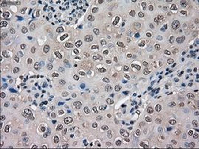 VMAT2 Antibody in Immunohistochemistry (Paraffin) (IHC (P))