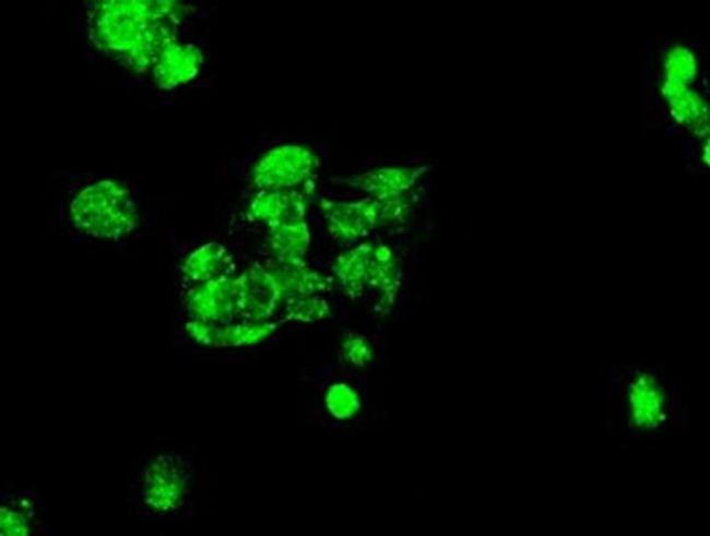 Kindlin 2 Antibody in Immunocytochemistry (ICC/IF)