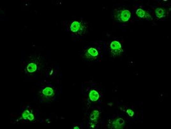 TRIB2 Antibody in Immunocytochemistry (ICC/IF)