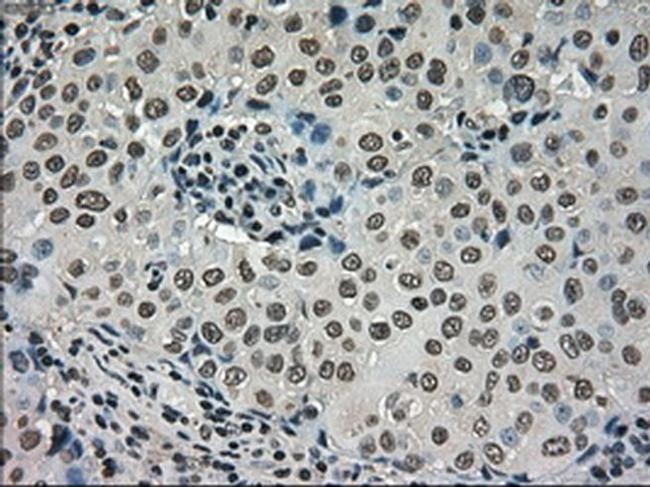 DHFR Antibody in Immunohistochemistry (Paraffin) (IHC (P))