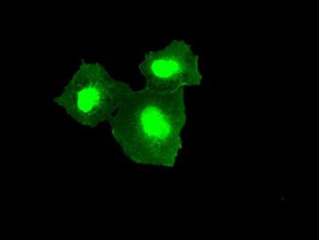 TMEM100 Antibody in Immunocytochemistry (ICC/IF)