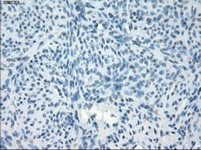 PDE10A Antibody in Immunohistochemistry (Paraffin) (IHC (P))