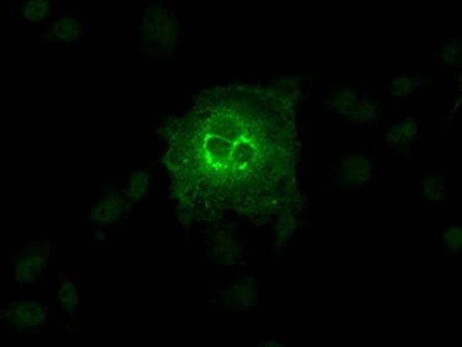 SLC2A6 Antibody in Immunocytochemistry (ICC/IF)