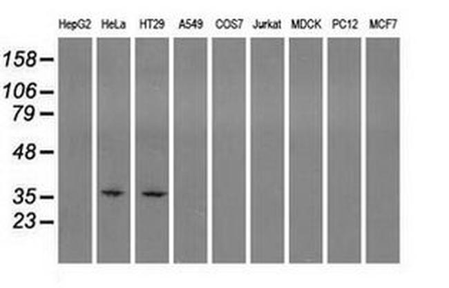 Sorbitol Dehydrogenase Antibody in Western Blot (WB)