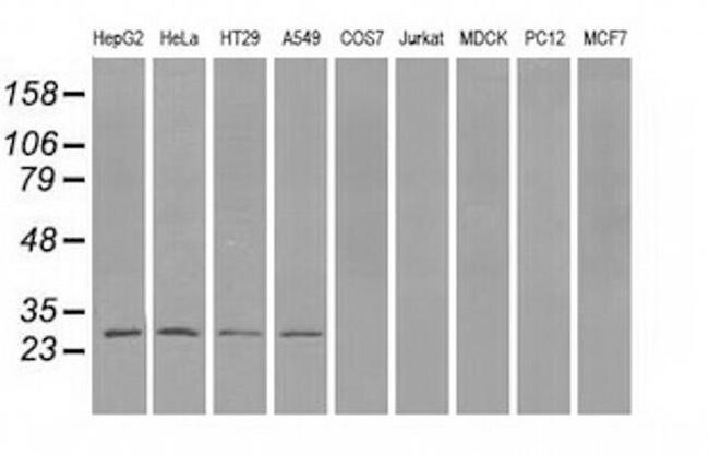 PSMA7 Antibody in Western Blot (WB)