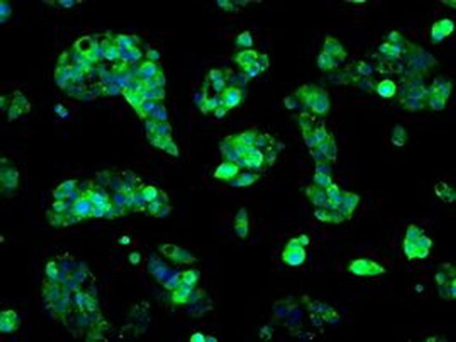 Sorbitol Dehydrogenase Antibody in Immunocytochemistry (ICC/IF)