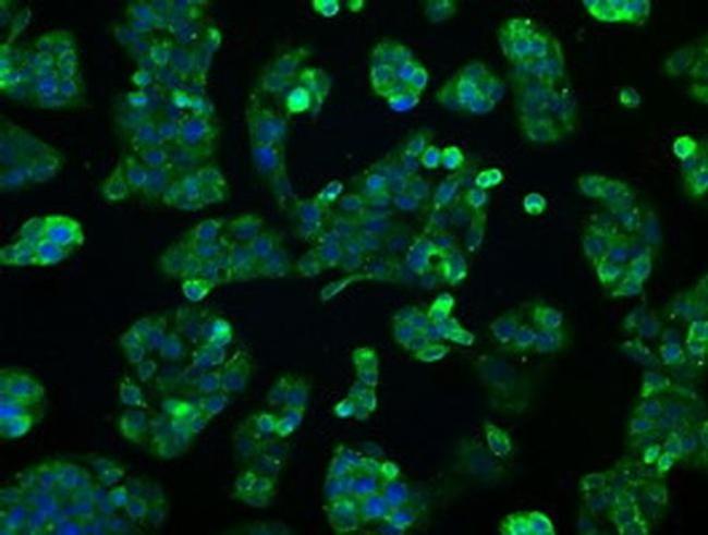 ERAB Antibody in Immunocytochemistry (ICC/IF)