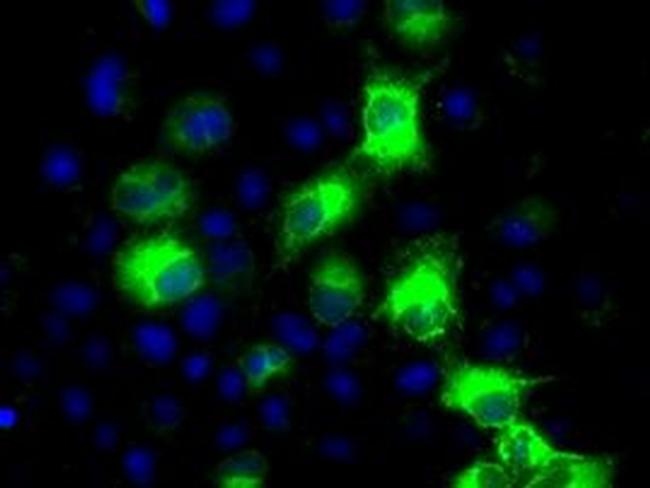 CYP2E1 Antibody in Immunocytochemistry (ICC/IF)