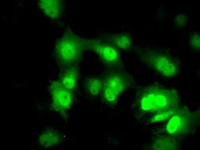 PPME1 Antibody in Immunocytochemistry (ICC/IF)