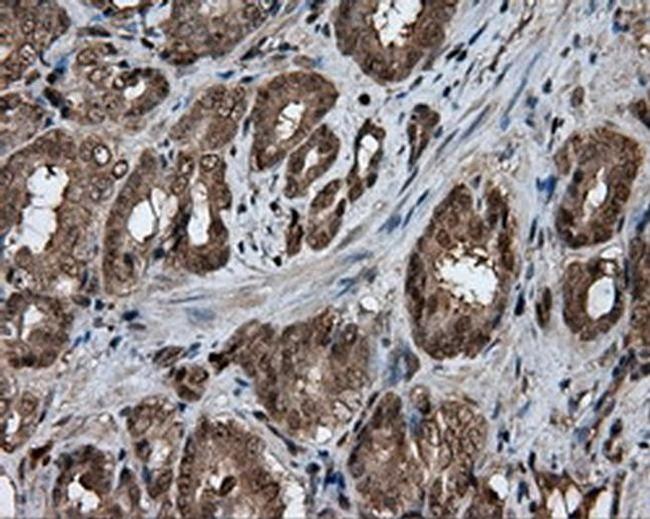 GBE1 Antibody in Immunohistochemistry (Paraffin) (IHC (P))