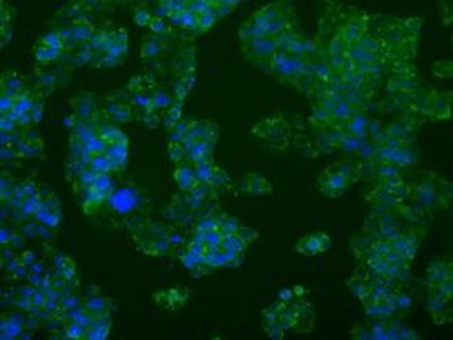 PFKFB4 Antibody in Immunocytochemistry (ICC/IF)