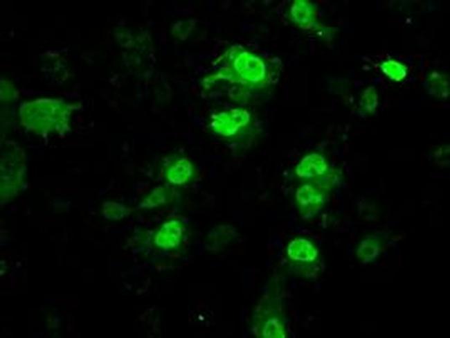 PPME1 Antibody in Immunocytochemistry (ICC/IF)