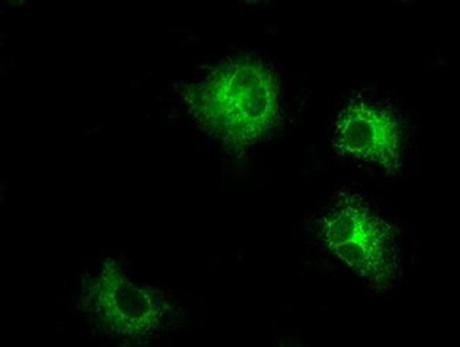 LOX Antibody in Immunocytochemistry (ICC/IF)