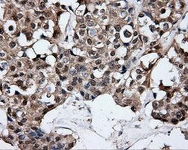 HuR Antibody in Immunohistochemistry (Paraffin) (IHC (P))