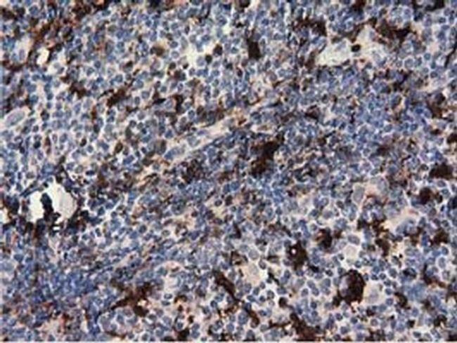 Pleckstrin Antibody in Immunohistochemistry (Paraffin) (IHC (P))