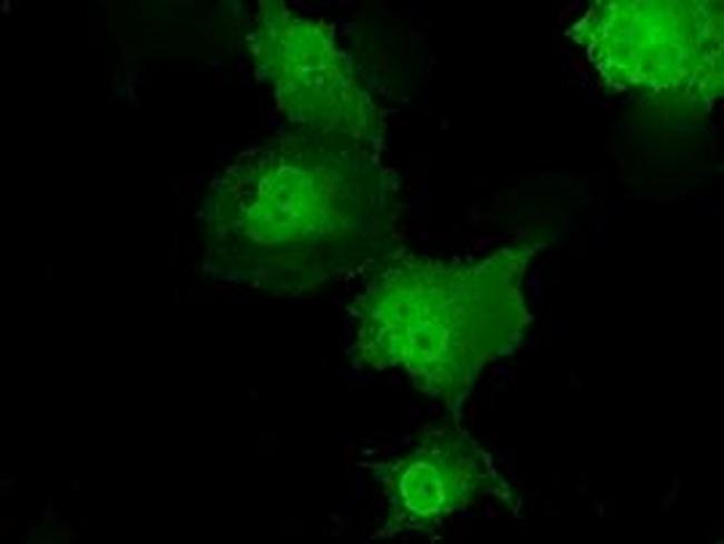 Transketolase Antibody in Immunocytochemistry (ICC/IF)