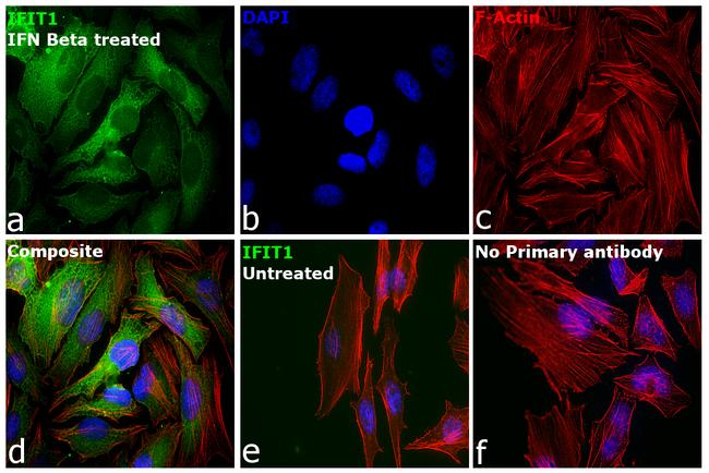 IFIT1 Antibody in Immunocytochemistry (ICC/IF)