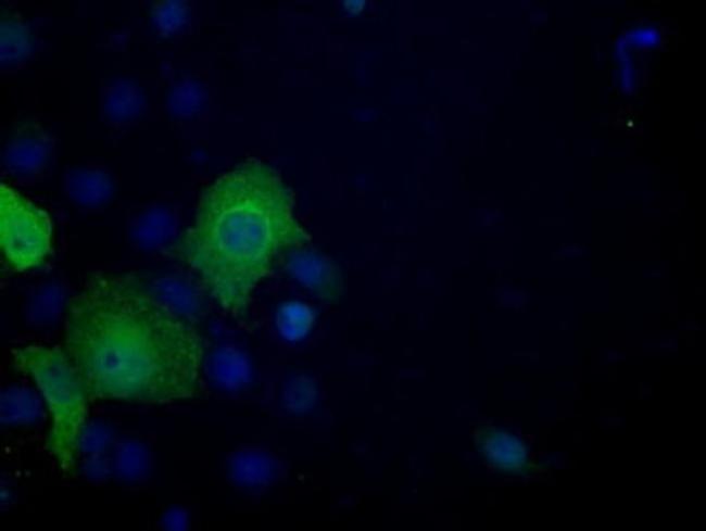 ATP Citrate Lyase Antibody in Immunocytochemistry (ICC/IF)