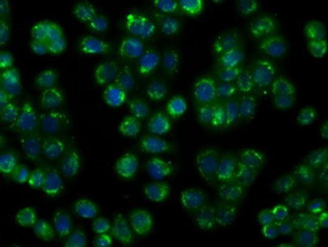 NIT1 Antibody in Immunocytochemistry (ICC/IF)