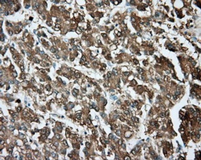 TPMT Antibody in Immunohistochemistry (Paraffin) (IHC (P))