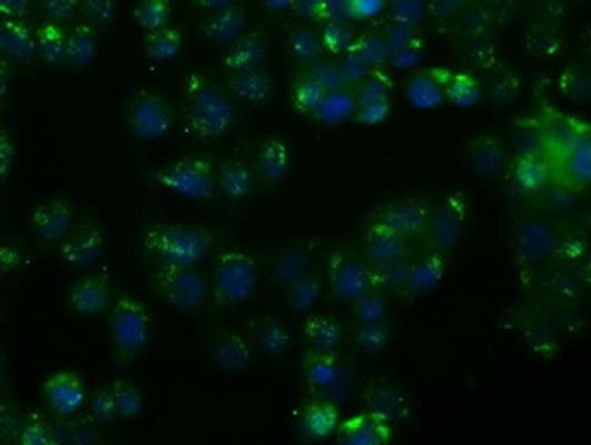 NIT1 Antibody in Immunocytochemistry (ICC/IF)